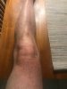 leftknee.jpg