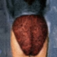 De-skirted