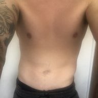 Micky35