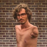 ArmlessGuy