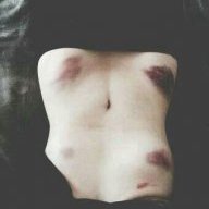 skinny_lovely