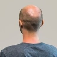 baldman3