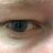 Baldprince74