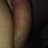 Rudolf755