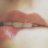 MisssX