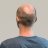 baldman3